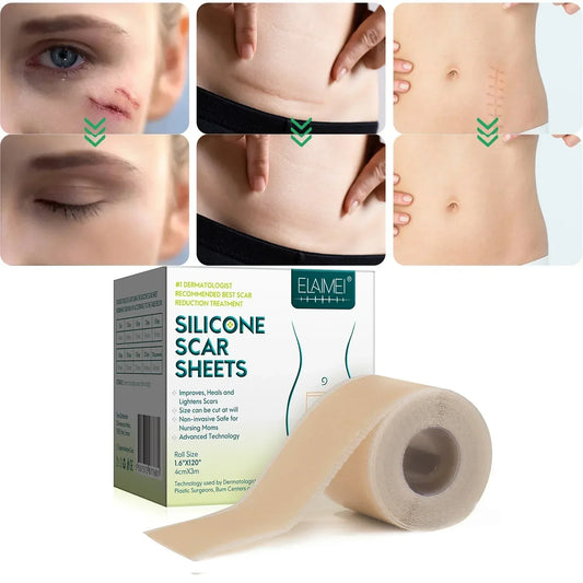 ELAIMEI Wholesale Effective Skin Therapy Scar Treatment Roll Silicone Gel Scar Sheets for New and Old Scars Removal